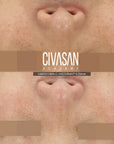 CIVASAN Varocobin C Professional Kit