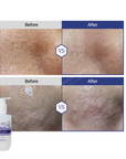 AESTHEIN Exosome Cleansing Gel 300ml