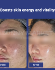 Before and after clinical results showing improved skin energy, radiance, and tightened texture using Aesthein Synergy Velvet Cream.