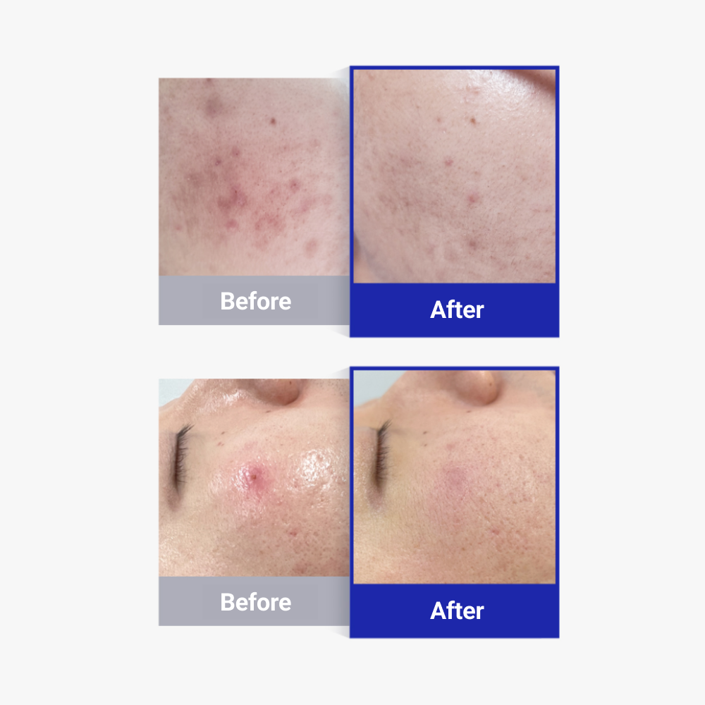 [DERMATHOD] Lactoregen Ampoule [6ml*5]