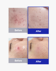 [DERMATHOD] Lactoregen Ampoule [6ml*5]