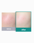 [DERMATHOD] Derma Revive Healer Gel [300ml]