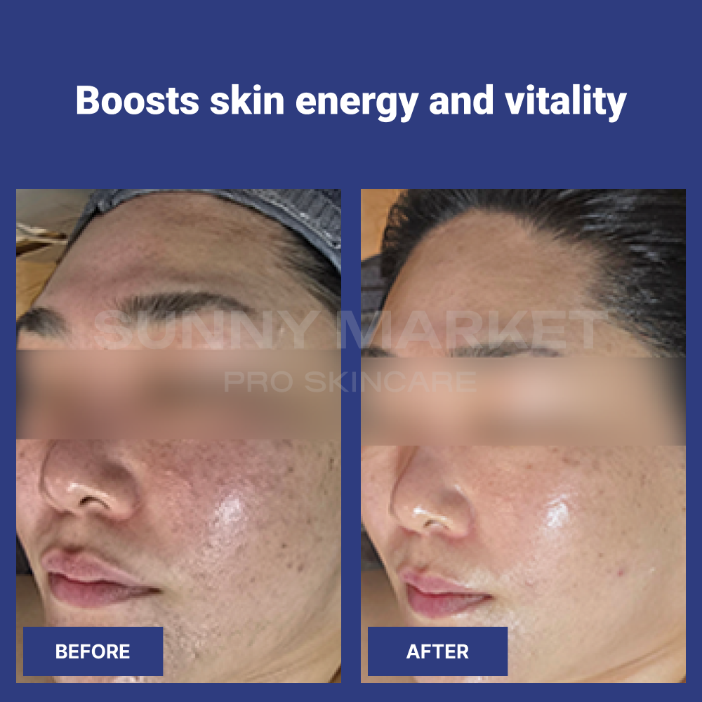 Before and after clinical results showing improved skin energy, radiance, and tightened texture using Aesthein Synergy Velvet Cream.