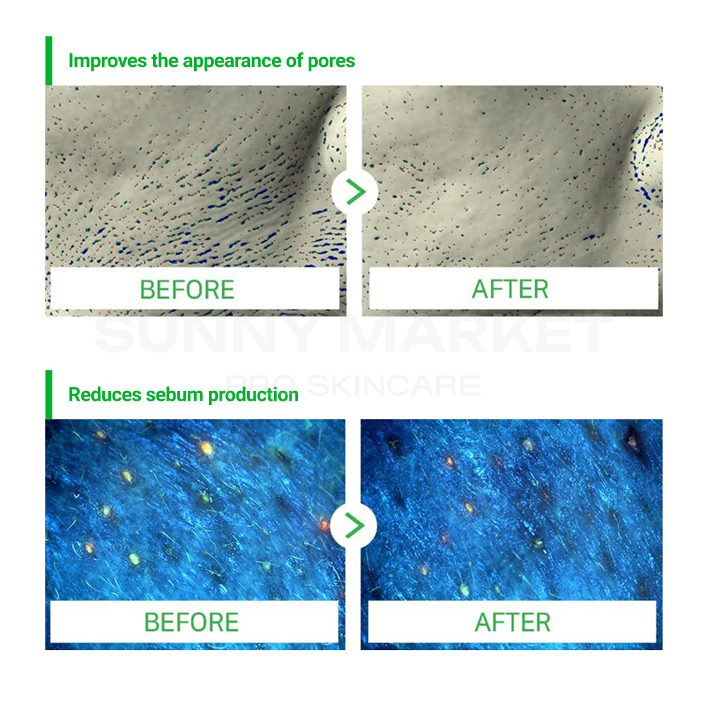 Artemisia Aka Toner &amp; Aka Tonner Pad Set