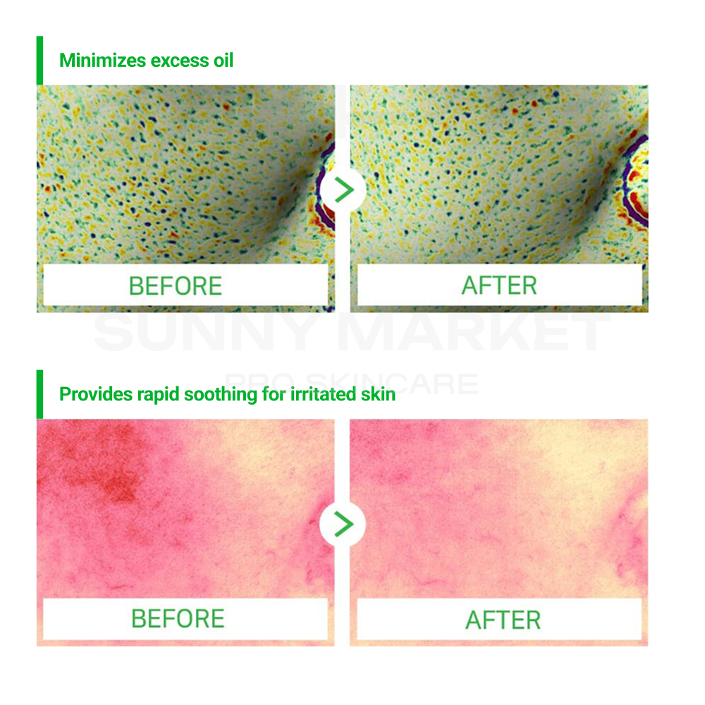Artemisia Aka Toner &amp; Aka Tonner Pad Set