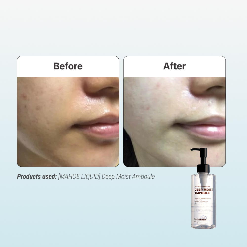 [MAHOE LIQUID] Deep Moist Ampoule [200ml]