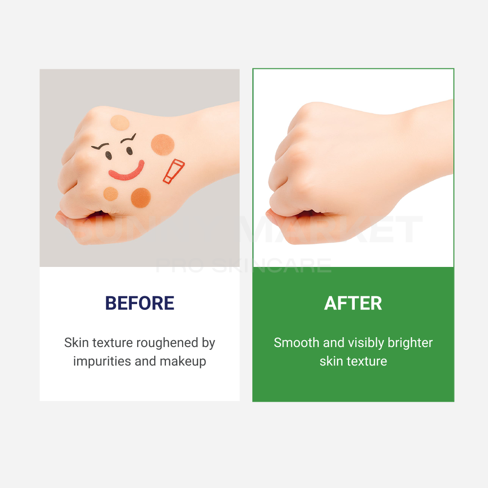 Foam cleanser improving rough skin texture for smoother and brighter looking skin