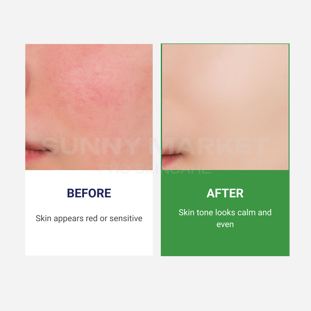 Hydrogel mask calming sensitive skin and improving skin tone appearance