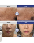 [AESTHEIN] Whitening Barrier Serum [50ml]