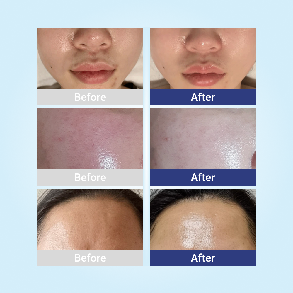 [AESTHEIN] All Skin Mask [10ea]