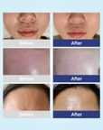 [AESTHEIN] All Skin Mask [10ea]