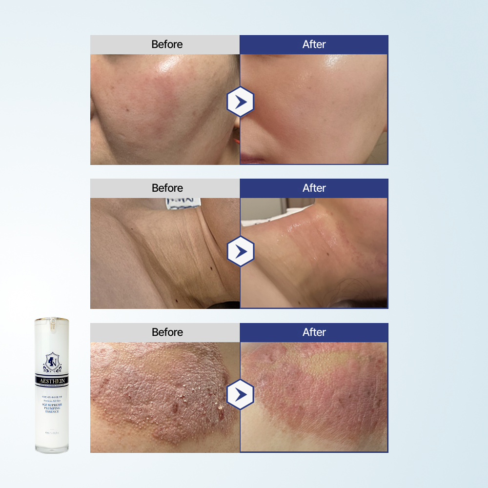 [AESTHEIN] All-Skin 4GF Supreme Plumping Essence [50ml]