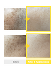 [DERMATHOD] DERMA LEVEL 345 LATOXIN MTS [4ml*8]
