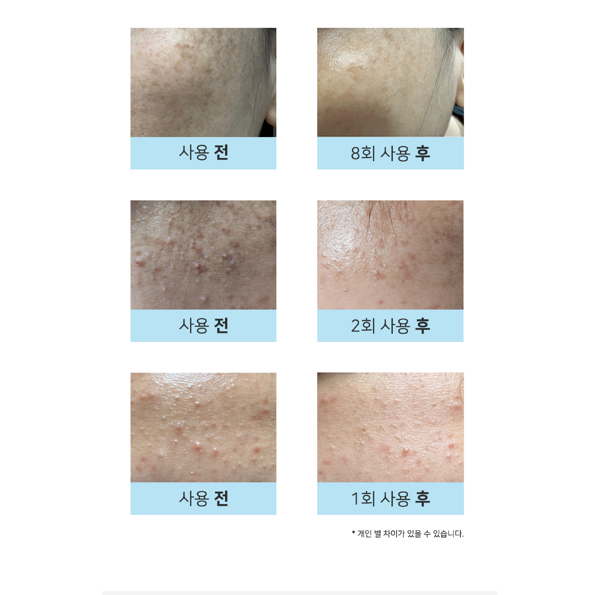 [DERMATHOD] O2 TOX PEEL 30ml