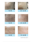 [DERMATHOD] O2 TOX PEEL 30ml