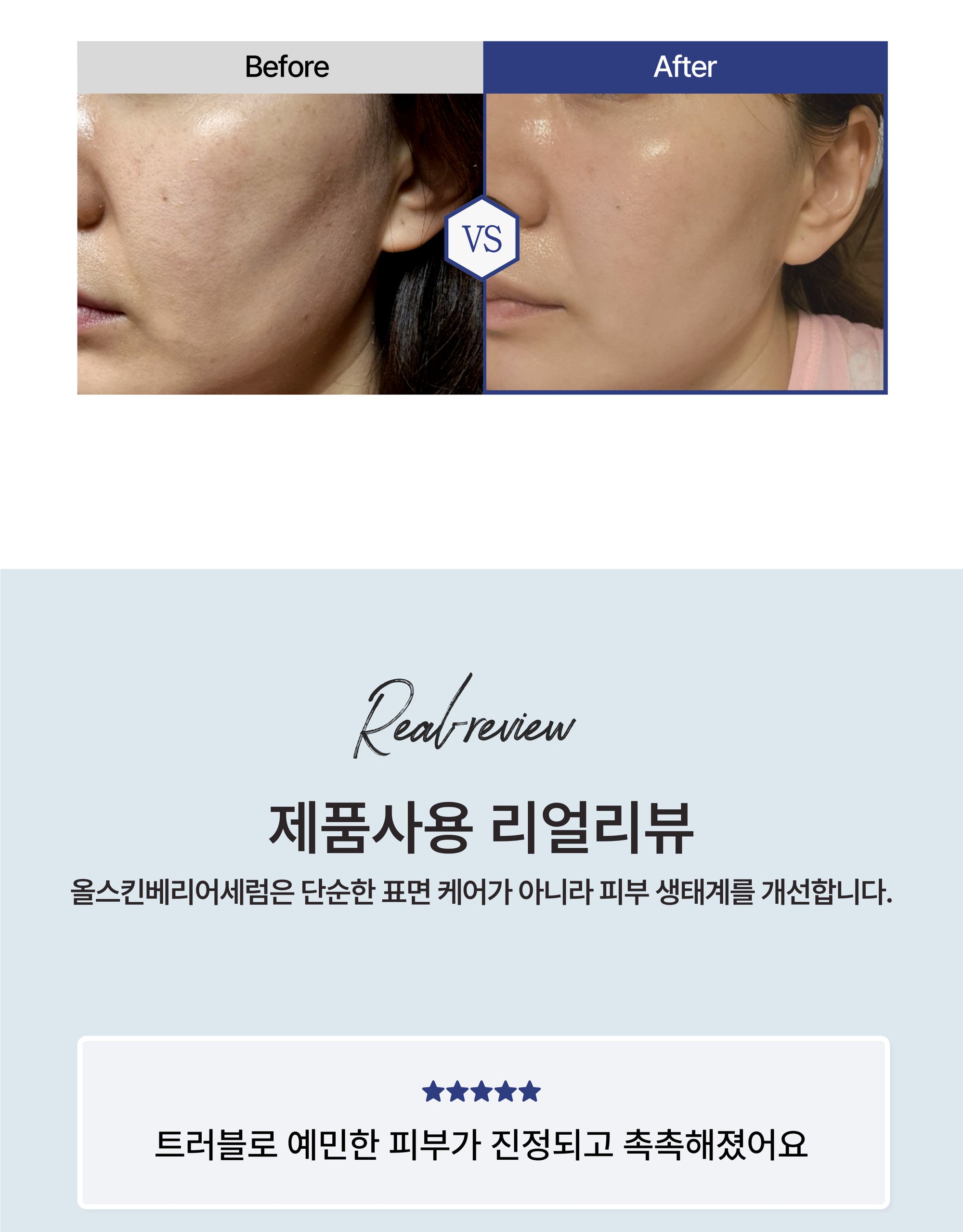 [AESTHEIN] Whitening Barrier Serum 50ml  에스테인 화이트닝 베리어 세럼