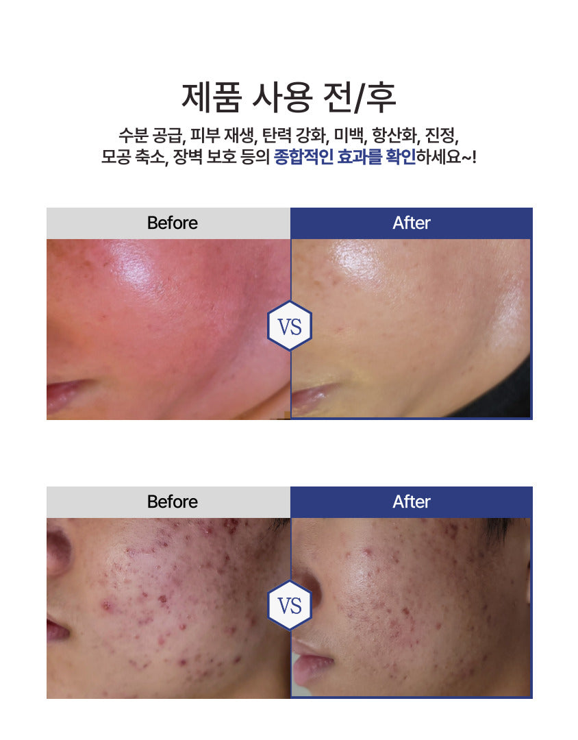 [Aesthein] All-Skin Medi Formula Ampoule 50ml 메디포뮬러 앰플