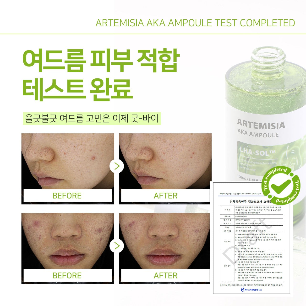 [SANTE] Artemisia AKA Ampoule 100ml 아카 앰플