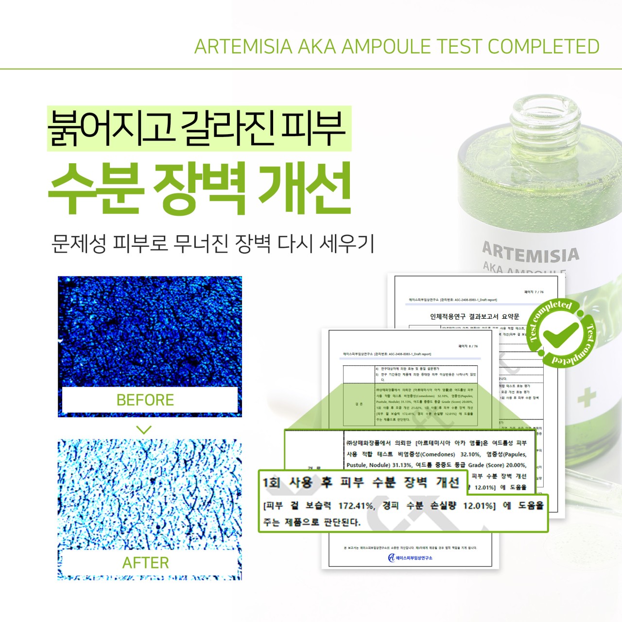 [SANTE] Artemisia AKA Ampoule 100ml 아카 앰플