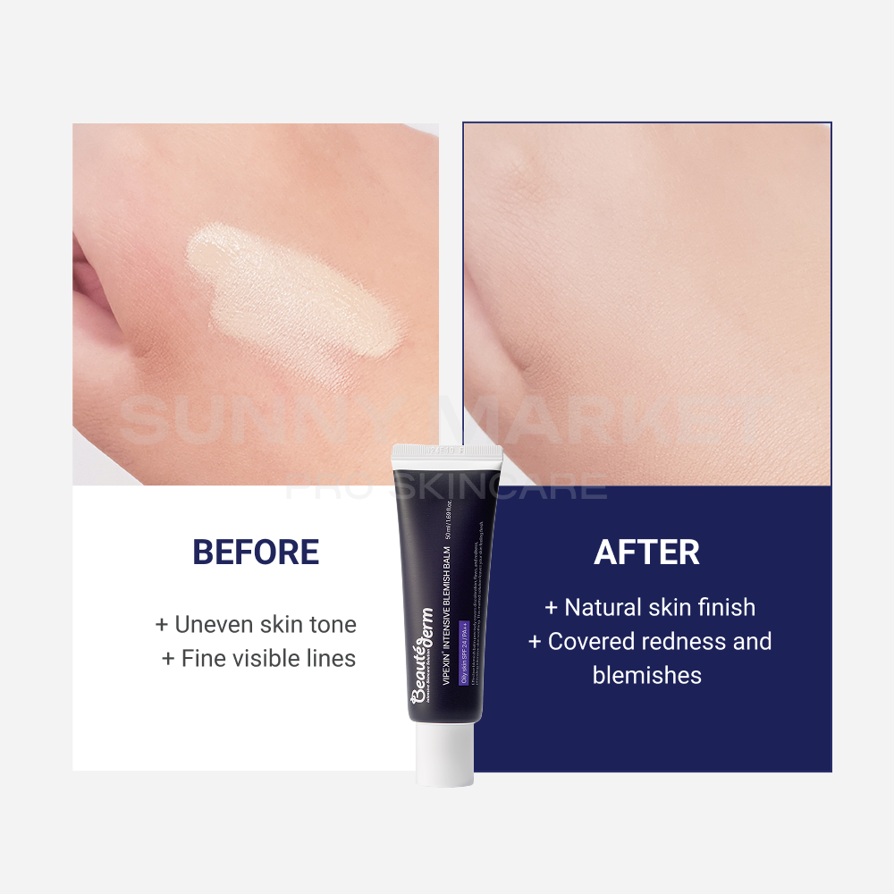 Beauteder Vipexin Intensive Blemish Balm before and after comparison showing improved tone, reduced redness, and natural skin finish