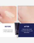Beauteder Vipexin Intensive Blemish Balm before and after comparison showing improved tone, reduced redness, and natural skin finish