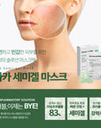 [SANTE] AKA Semigel Mask 1box(5ea) 세미겔 마스크