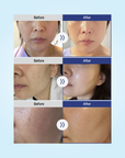 [AESTHEIN] Anti-Pollution Shield Day Cream [50ml]